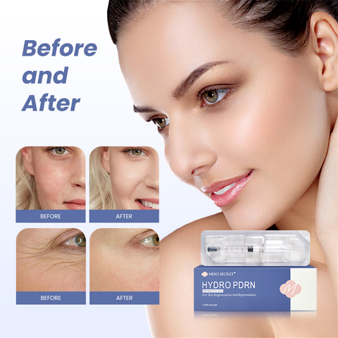 Meso Secret® Hydro PDRN Skinbooster