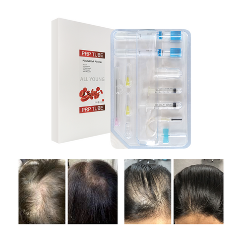 Platelet-rich Plasma Kit ACD Gel Biotin Complete PRP Therapy Set