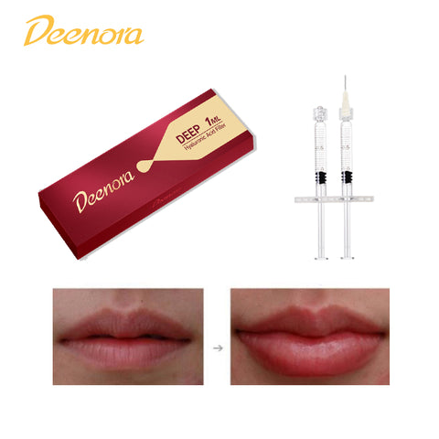 Deenora Hyaluronic Acid Filler with Lidocaine