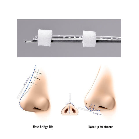 PDO PCL Nose Tip Bridge Lifting Thread