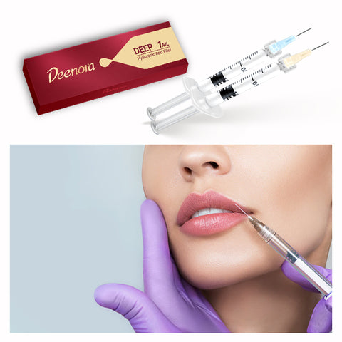 Professional Hyaluronic Acid Dermal Filler for Facial Aesthetics