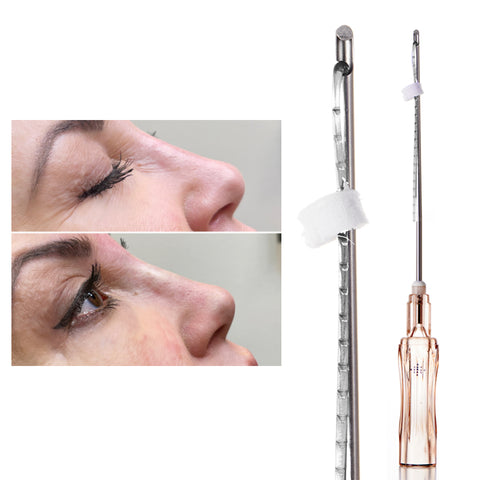 PDO PCL Nose Tip Bridge Lifting Thread