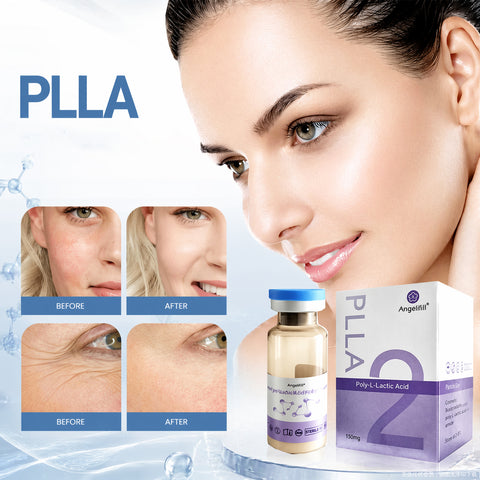 Angelfill PLLA Relleno Estimulador De Colágeno Facial y Corporal