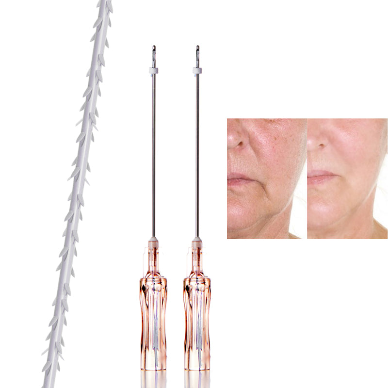 PLLA Traction Thread Cog 3D 4D 6D – Deenorathread